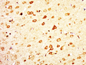 C12ORF68 Rabbit Polyclonal Antibody