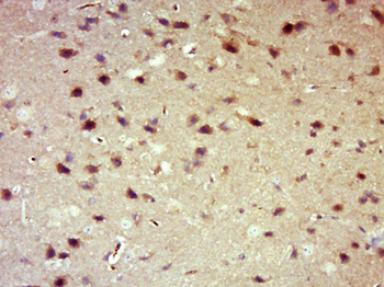 14-3-3 Alpha + Beta + Gamma + Delta + Epsilon Rabbit Polyclonal Antibody