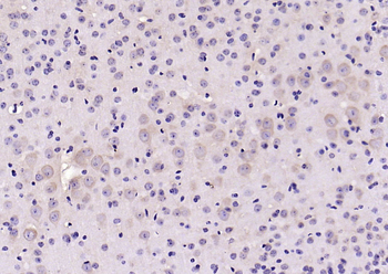 14-3-3 Alpha + Beta + Gamma + Delta + Epsilon Rabbit Polyclonal Antibody