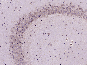 Serotonin transporter Rabbit Polyclonal Antibody