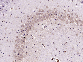 Serotonin transporter Rabbit Polyclonal Antibody