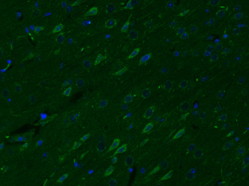 5HT4 Receptor Rabbit Polyclonal Antibody