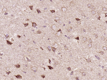 ADAR1 Rabbit Polyclonal Antibody