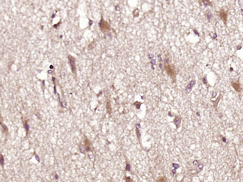 Vasopressin Rabbit Polyclonal Antibody