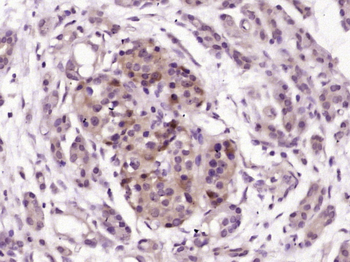 Pancreatic hormone Rabbit Polyclonal Antibody