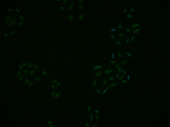 AIMP2 Rabbit Polyclonal Antibody