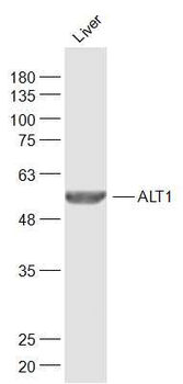 ALT1 Rabbit Polyclonal Antibody