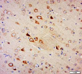 Amphiphysin Rabbit Polyclonal Antibody