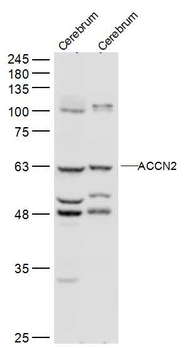 ACCN2 Rabbit Polyclonal Antibody