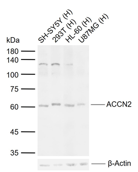 ACCN2 Rabbit Polyclonal Antibody