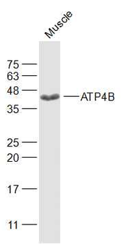 ATP4B Rabbit Polyclonal Antibody