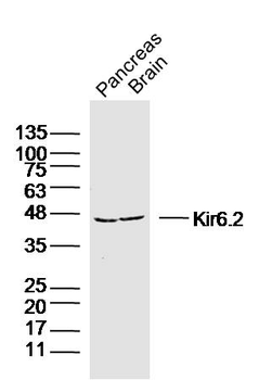 Kir6.2 Rabbit Polyclonal Antibody