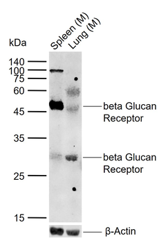 CLEC7A Rabbit Polyclonal Antibody