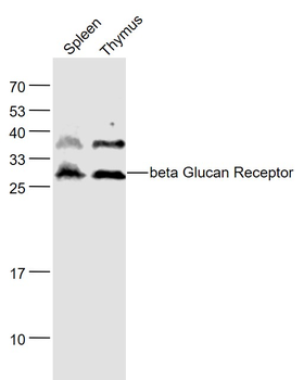 CLEC7A Rabbit Polyclonal Antibody