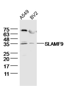 SLAMF9 Rabbit Polyclonal Antibody