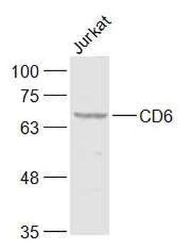 CD6 Rabbit Polyclonal Antibody