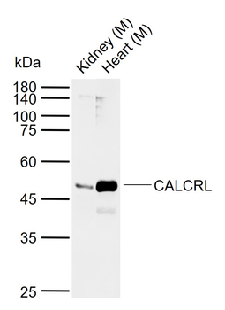 CALCRL Rabbit Polyclonal Antibody