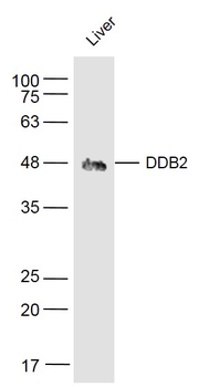 DDB2 Rabbit Polyclonal Antibody