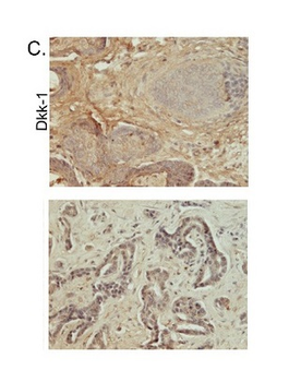 DKK1 Rabbit Polyclonal Antibody