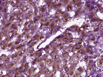 Desmoplakin I+II Rabbit Polyclonal Antibody