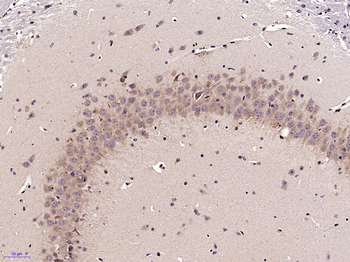 ECE2 Rabbit Polyclonal Antibody