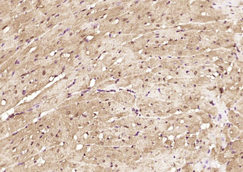 PRKAG2 Rabbit Polyclonal Antibody