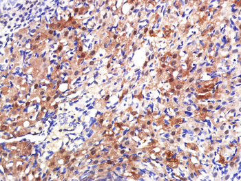 Estrogen Receptor alpha Rabbit Polyclonal Antibody