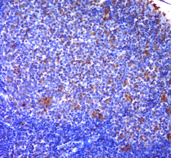 FDC-SP Rabbit Polyclonal Antibody