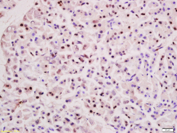 FOXO1 Rabbit Polyclonal Antibody