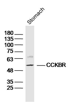 CCKBR Rabbit Polyclonal Antibody