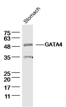 GATA4 Rabbit Polyclonal Antibody