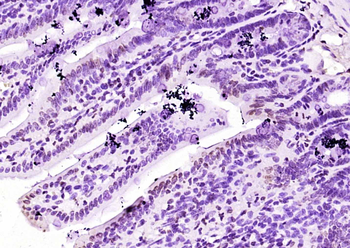 GATA6 Rabbit Polyclonal Antibody