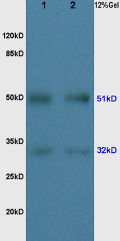 GLK Rabbit Polyclonal Antibody