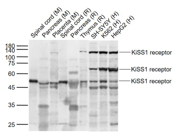 KiSS1 receptor Rabbit Polyclonal Antibody