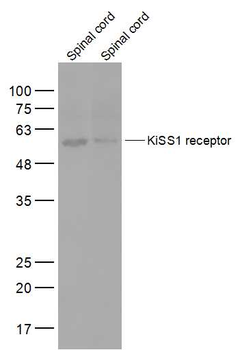 KiSS1 receptor Rabbit Polyclonal Antibody