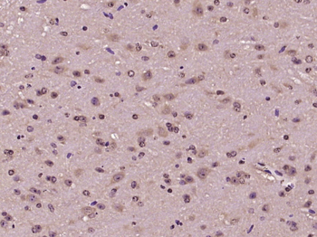 GTSE1 Rabbit Polyclonal Antibody