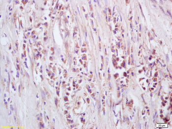 GTSE1 Rabbit Polyclonal Antibody