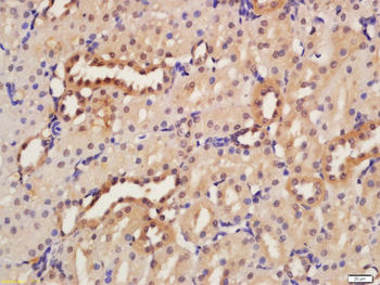 HER2 Rabbit Polyclonal Antibody