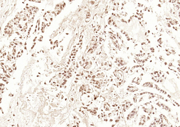 HDAC3 Rabbit Polyclonal Antibody