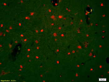 HDAC3 Rabbit Polyclonal Antibody