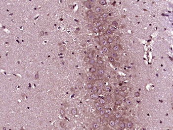 HRG1 Rabbit Polyclonal Antibody