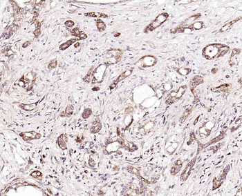 Hrasls3 Rabbit Polyclonal Antibody