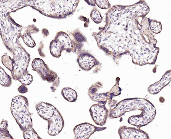 Hrasls3 Rabbit Polyclonal Antibody