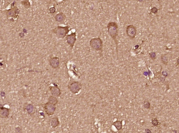 Interferon alpha 2b Rabbit Polyclonal Antibody