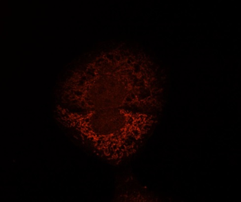 Mitofilin Rabbit Polyclonal Antibody