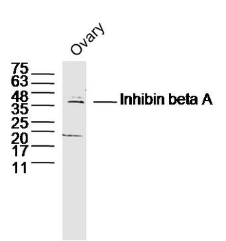 Inhibin beta A Rabbit Polyclonal Antibody