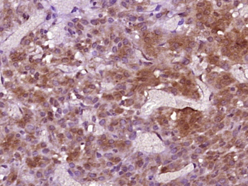 Inhibin beta B Rabbit Polyclonal Antibody