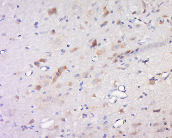 Inhibin Beta C Rabbit Polyclonal Antibody