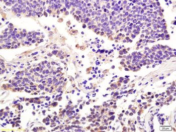 ITGA7 Rabbit Polyclonal Antibody