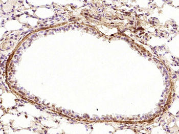 Phospho-JAK2 (Tyr1007+Tyr1008) Rabbit Polyclonal Antibody
